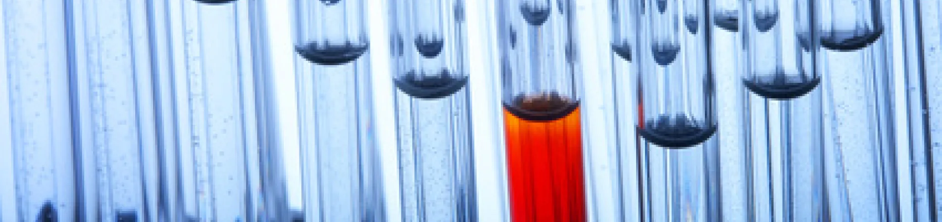 großes Blutbild, Nahrungsmittelunverträglichkeiten, Entzündungswerte, HPU, KPU, Häemopyrrolactamurie, Krypropyrrolurie, Mineralstoffprofil, Immunologie, Rheumawerte, Allergiediagnostik, Nierenwerte, Fettstoffwechsel, Leberwerte, Mineralstoffwechsel, Verdauungssystem, Schilddrüse, Herz, Bauchspeicheldrüse